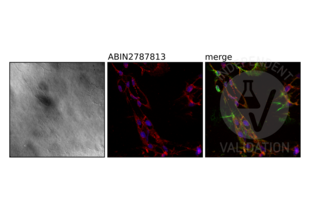 Immunohistochemistry validation image for anti-Nardilysin (N-Arginine Dibasic Convertase) (NRD1) (Middle Region) antibody (ABIN2787813)