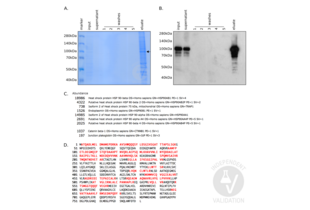 Immunoprecipitation validation image for anti-Catenin (Cadherin-Associated Protein), beta 1, 88kDa (CTNNB1) antibody (Magnetic Particles) (ABIN1690141)