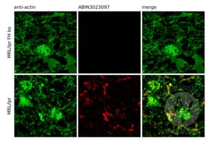 Immunofluorescence validation image for anti-Complement Factor H (CFH) antibody (ABIN3023097)
