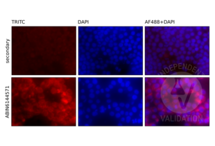 Immunofluorescence validation image for anti-Nuclear Factor of kappa Light Polypeptide Gene Enhancer in B-Cells 1 (NFKB1) antibody (ABIN6144571)