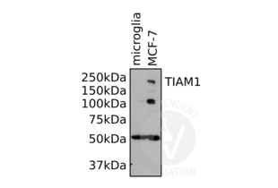 Western Blotting validation image for anti-T-Cell Lymphoma Invasion and Metastasis 1 (TIAM1) (AA 1-378) antibody (ABIN1982879)