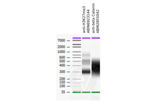 Cleavage Under Targets and Release Using Nuclease validation image for anti-Catenin (Cadherin-Associated Protein), beta 1, 88kDa (CTNNB1) (N-Term) antibody (ABIN2855042)