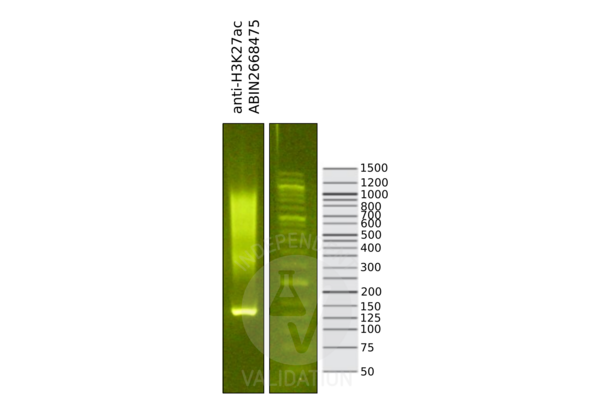 Histone 3 anticorps  (H3K27ac)