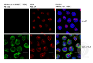 Immunofluorescence validation image for anti-Nucleophosmin (Nucleolar phosphoprotein B23, Numatrin) (NPM1) (AA 250-298), (C-Term) antibody (ABIN1737584)
