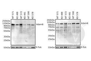 Western Blotting validation image for anti-ADAM Metallopeptidase Domain 8 (ADAM8) (AA 145-493) antibody (ABIN1866534)