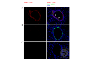 Immunofluorescence validation image for anti-Cytochrome P450, Family 4, Subfamily B, Polypeptide 1 (CYP4B1) (N-Term) antibody (ABIN2777006)