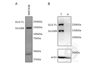 Western Blotting validation image for anti-GLI Family Zinc Finger 2 (GLI2) (Middle Region) antibody (ABIN2777474)