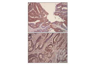 Immunohistochemistry validation image for anti-GLI Family Zinc Finger 2 (GLI2) (Middle Region) antibody (ABIN2777474)