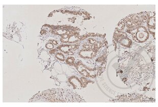 Immunohistochemistry validation image for anti-Aquaporin 2 (Collecting Duct) (AQP2) (AA 171-271) antibody (ABIN707576)