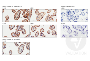 Immunohistochemistry validation image for anti-CD200 Receptor 1-Like (CD200R1L) (AA 151-250) antibody (ABIN1715098)