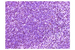 CD4 antibody  (AA 385-457)