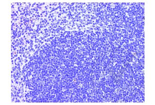 Immunohistochemistry validation image for anti-CD4 (CD4) (AA 385-457) antibody (ABIN671376)