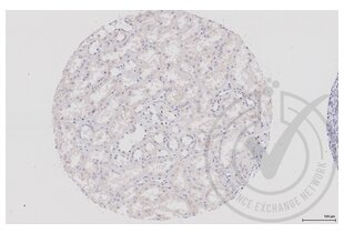 Immunohistochemistry validation image for anti-Dishevelled Segment Polarity Protein 1 (DVL1) (AA 21-100) antibody (ABIN670671)