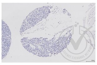 Immunohistochemistry validation image for anti-Eukaryotic Translation Initiation Factor 4E (EIF4E) (AA 121-217) antibody (ABIN1386772)