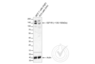Western Blotting validation image for anti-Insulin-Like Growth Factor 1 Receptor (IGF1R) (AA 251-350) antibody (ABIN726575)