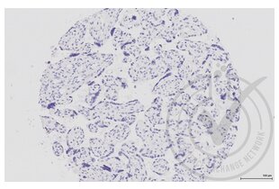 Immunohistochemistry validation image for anti-Mitogen-Activated Protein Kinase 14 (MAPK14) (pThr180), (pTyr182) antibody (ABIN678668)