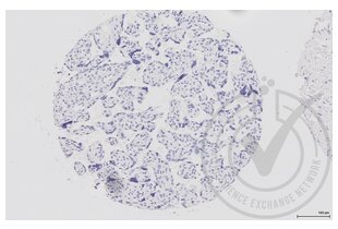 Immunohistochemistry validation image for anti-Mitogen-Activated Protein Kinase 14 (MAPK14) (pThr180), (pTyr182) antibody (ABIN678668)