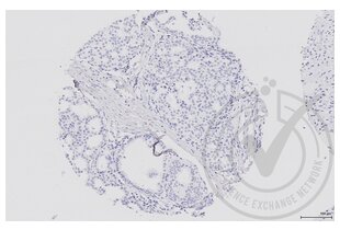 Immunohistochemistry validation image for anti-Mitogen-Activated Protein Kinase Kinase 5 (MAP2K5) (AA 251-350) antibody (ABIN754183)