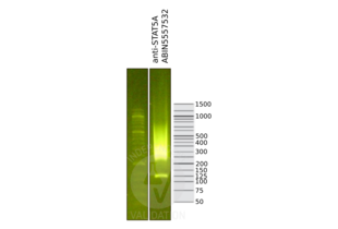 Cleavage Under Targets and Release Using Nuclease validation image for anti-Signal Transducer and Activator of Transcription 5A (STAT5A) antibody (ABIN5557532)