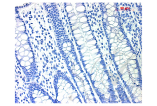 Immunohistochemistry validation image for anti-TGF beta Receptor 1 (AA 301-400) antibody (ABIN671256)
