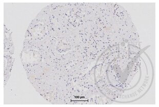 Immunohistochemistry validation image for anti-Tight Junction Protein 1 (TJP1) (AA 1551-1702) antibody (ABIN675024)