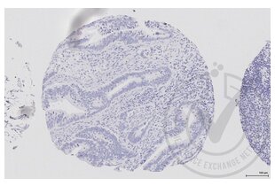 Immunohistochemistry validation image for anti-V-Raf-1 Murine Leukemia Viral Oncogene Homolog 1 (RAF1) (AA 31-130) antibody (ABIN733208)