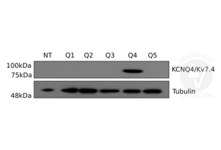 Western Blotting validation image for anti-Potassium Voltage-Gated Channel, KQT-Like Subfamily, Member 4 (KCNQ4) antibody (ABIN1304779)