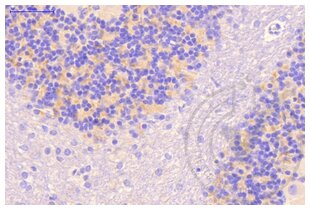 Immunohistochemistry validation image for anti-Clathrin (AA 4-171) antibody (ABIN968006)