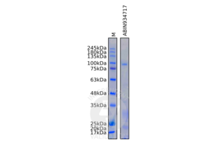SDS-PAGE validation image for Thyroid Peroxidase (TPO) protein (ABIN934717)