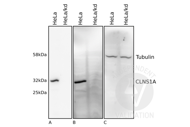 CLNS1A anticorps