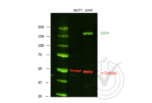 Western Blotting validation image for anti-Epidermal Growth Factor Receptor (EGFR) antibody (ABIN98862)