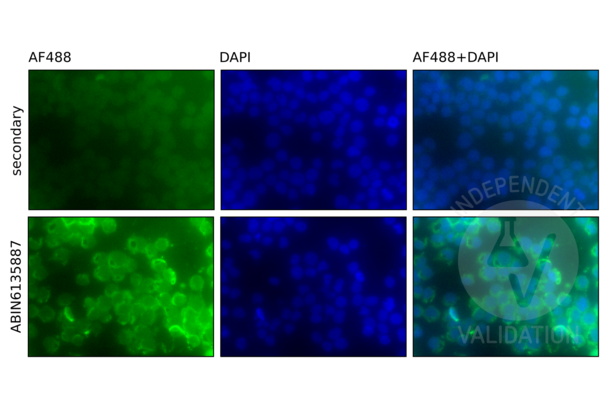 NF-kB p65 anticorps