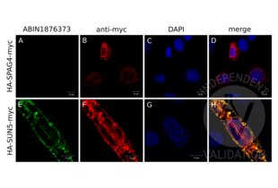Immunocytochemistry validation image for anti-Sad1 and UNC84 Domain Containing 5 (SUN5) antibody (ABIN1876373)
