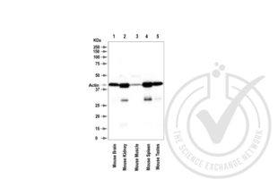 beta Actin antibody  (AA 2-16)