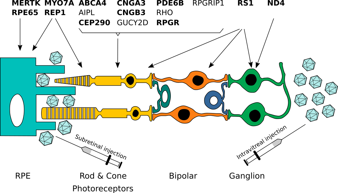 Représentation schématique de la rétine et du schéma d'expression des gènes rétiniens. Les gènes pour lesquels des approches de thérapie génique sont en cours de test clinique sont indiqués en gras. EPR : épithélium pigmentaire rétinien.