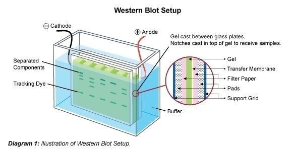 What is the cost of a Western blot test?