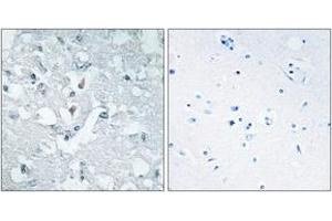 Image no. 2 for anti-Glycerate Kinase (GLYCTK) (AA 101-150) antibody (ABIN1533988)