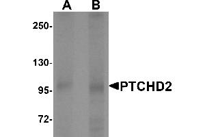 Western blot analysis of PTCHD2 in mouse kidney tissue lysate with PTCHD2 antibody at (A) 1 and (B) 2 µg/mL.