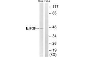 Image no. 1 for anti-Eukaryotic Translation Initiation Factor 3 Subunit F (EIF3F) (AA 81-130) antibody (ABIN1534899)