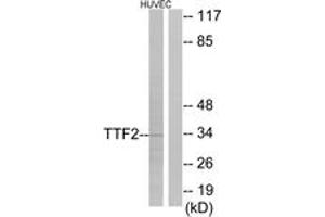 Image no. 1 for anti-Forkhead Box E1 (Thyroid Transcription Factor 2) (FOXE1) (AA 10-59) antibody (ABIN2889304)