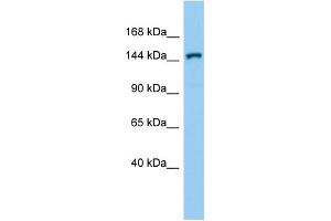 Image no. 1 for anti-Corin, Serine Peptidase (CORIN) (C-Term) antibody (ABIN2782724)