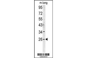 Western Blotting (WB) image for anti-DnaJ (Hsp40) Homolog, Subfamily C, Member 8 (DNAJC8) antibody (ABIN2158579)