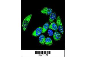 Image no. 2 for anti-Wilms Tumor 1 (WT1) (Center) antibody (ABIN2494167)