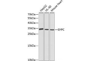 Western blot analysis of extracts of various cell lines using GYPC Polyclonal Antibody at dilution of 1:1000.