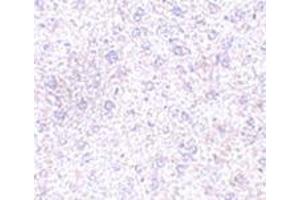 Image no. 1 for anti-Plexin Domain Containing 1 (PLXDC1) (C-Term) antibody (ABIN500899)