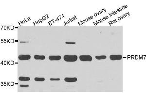 Image no. 1 for anti-PR Domain Containing 7 (PRDM7) antibody (ABIN2737413)