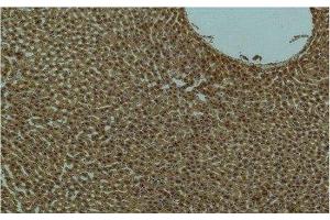 Immunohistochemistry of paraffin-embedded Rat liver tissue using PI 3 kinase p85 alpha Monoclonal Antibody at dilution of 1:200.