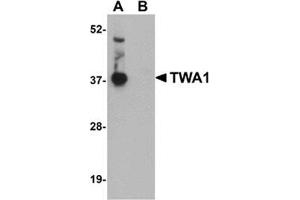 Image no. 2 for anti-Tetratricopeptide Repeat Domain 5 (TTC5) (C-Term) antibody (ABIN501091)