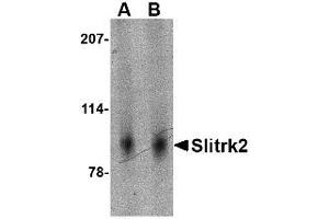 Image no. 1 for anti-SLIT and NTRK-Like Family, Member 2 (SLITRK2) (Internal Region) antibody (ABIN1493816)