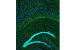 Indirect immunostaining of PFA fixed mouse brain section (dilution 1 : 200; green).